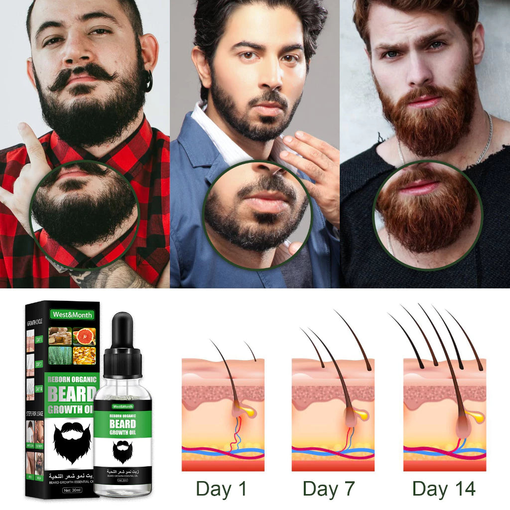 CABELLO, BARBA, CALVICIE, crecimiento